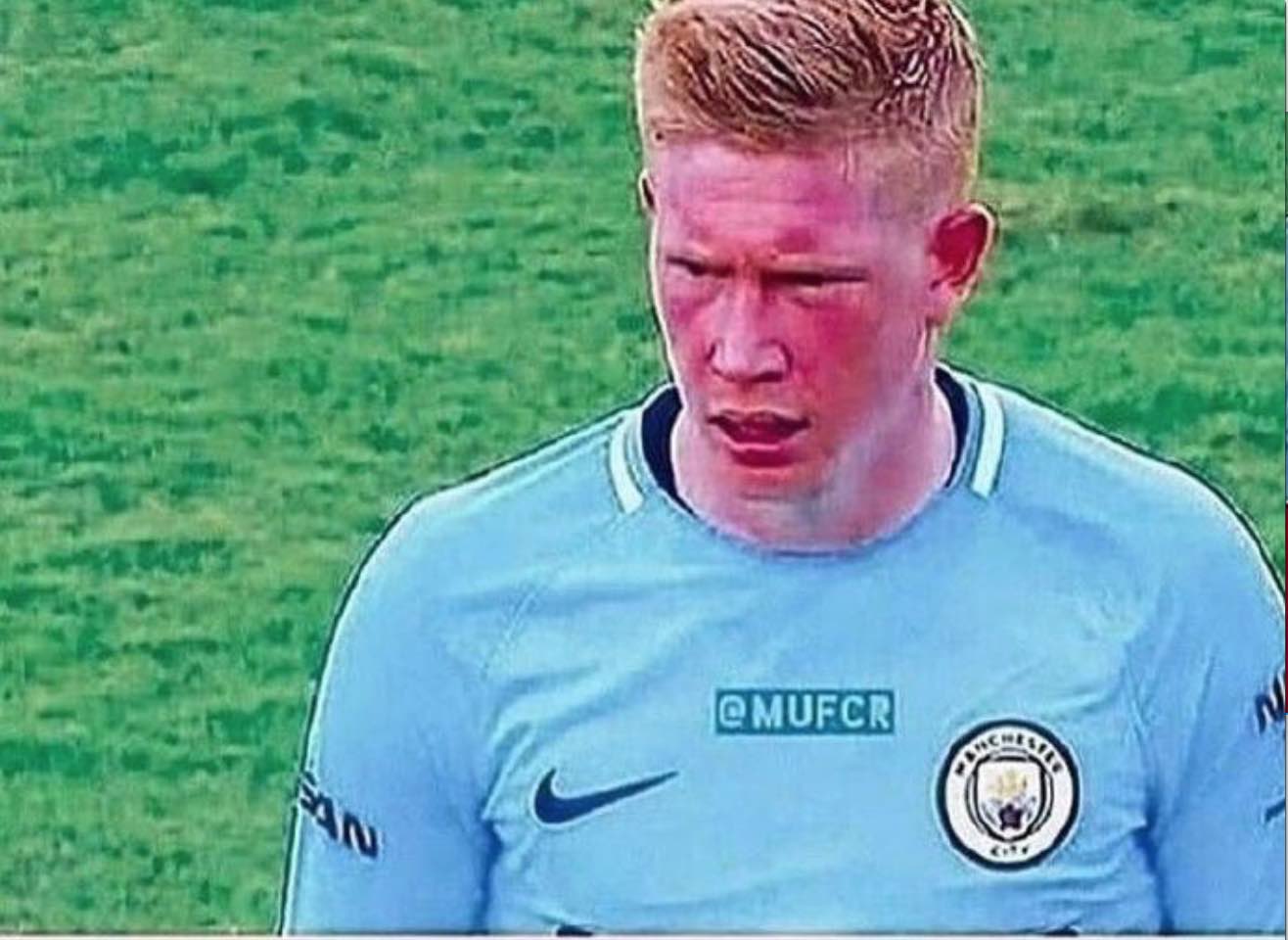 拓记：克林根争抢篮板后一瘸一拐走向替补席，赛前左小腿就有挫伤